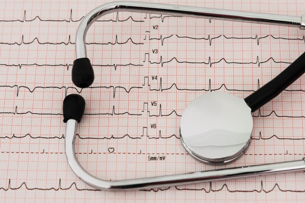 Cardiologia_San Francesco_Eco di bergamo_Istituto Madre Rubatto