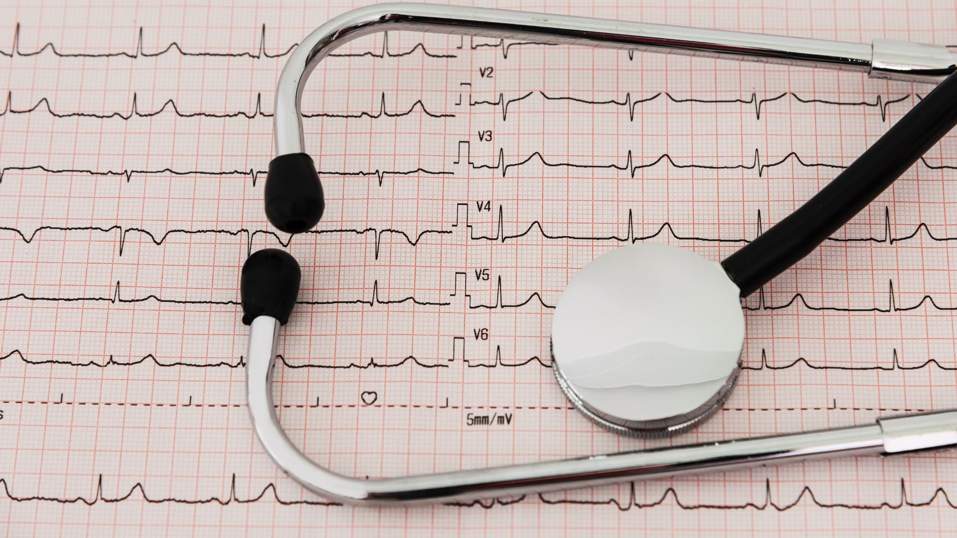 Cardiologia_San Francesco_Eco di bergamo_Istituto Madre Rubatto